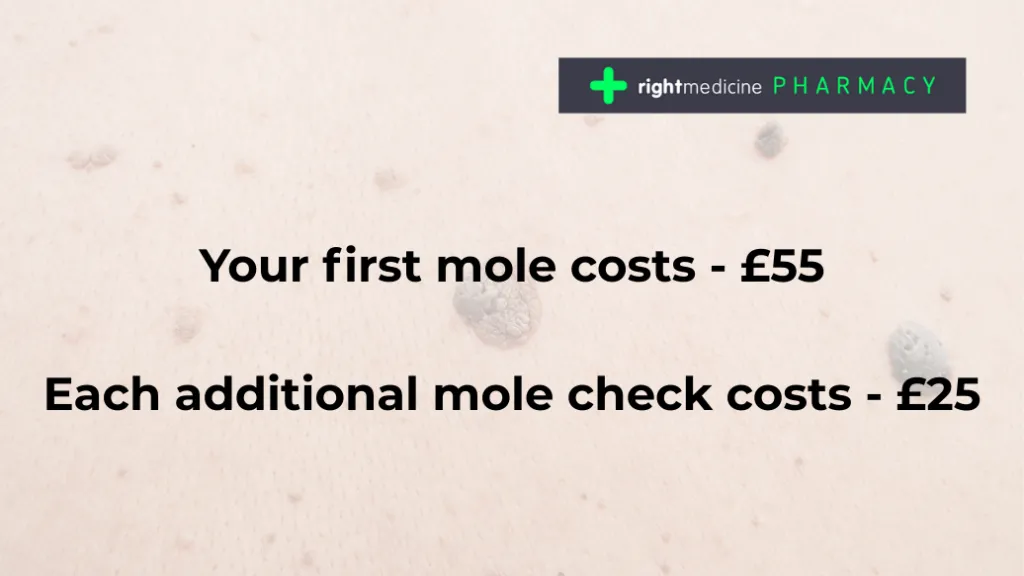 Mole check pricing at Right Medicine Pharmacy – £55 for the first mole and £25 for each additional mole